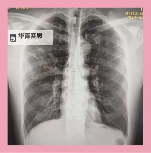 2025年胸片曝光在线看全新更新,开启医学影像新纪元图1