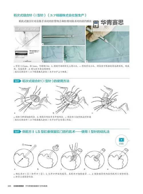 转过去腿趴好准备打直肠针:护理步骤与注意事项图2