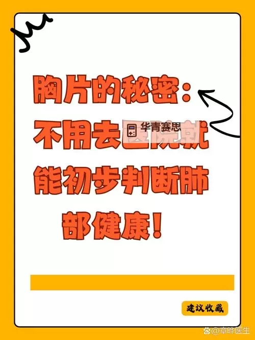 免费无病毒,保障健康:100%胸片曝光率无忧体验图1
