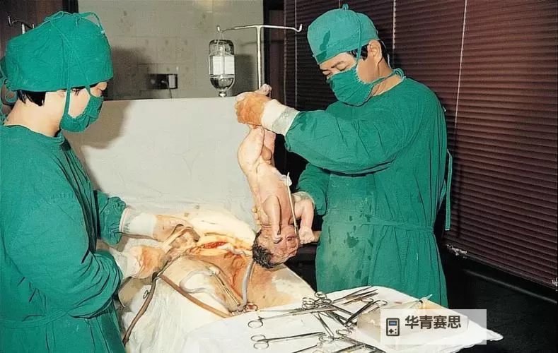 真实还原:孕妇分娩视频过程全纪录图1
